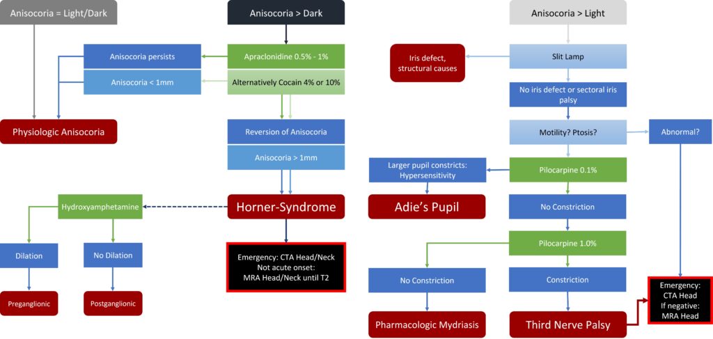 Anisocoria - Ophtha.info